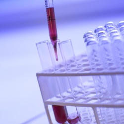 Análisis rápido de colesterol y glucemia