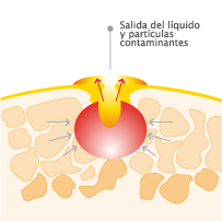 proceso_curacion_02