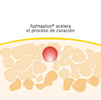 proceso_curacion_03