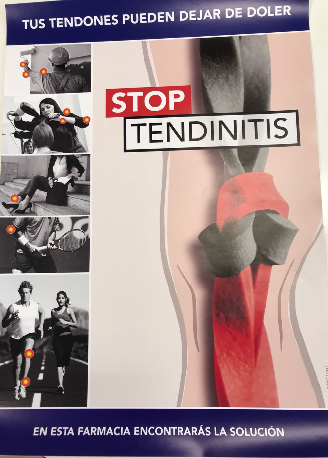 Tendinitis: Consejos para su tratamiento y prevención