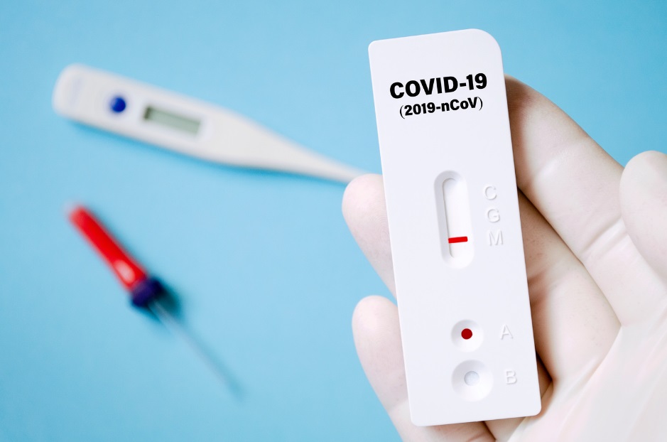 ¿Cómo realizar un correcto uso del test autodiagnóstico de la Covid-19?