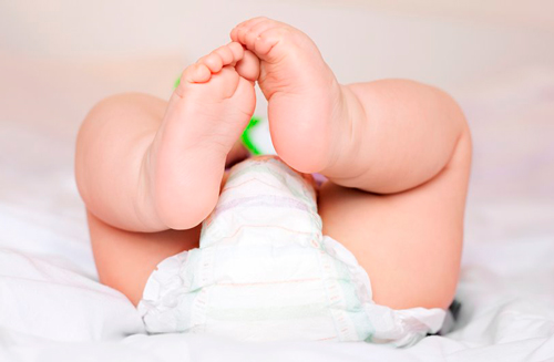 Qué es y cómo tratar la dermatitis del pañal 