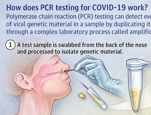 PCR Test para la detección del Coronavirus SARS-COV-2