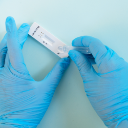 CITA PRÈVIA Test antígens 