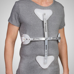 Cors&eacute; de hiperextensi&oacute;n cruciforme