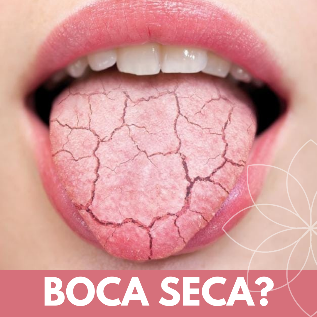 BOCA SECA O XEROSTOMIA